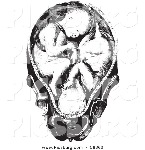 Clip Art of an Old Fashioned Vintage Twins in a Womb Black and White